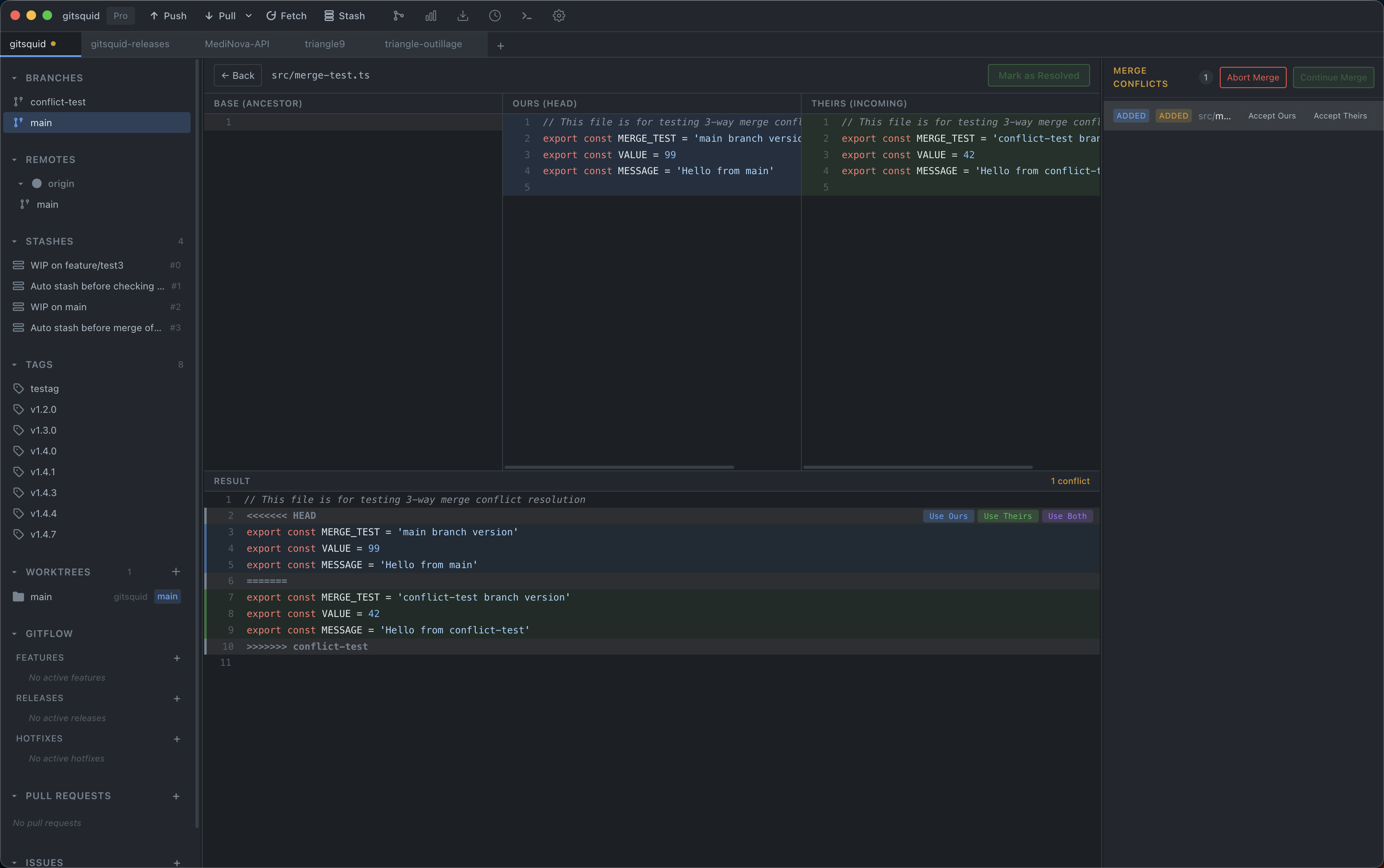 3-Way Merge Editor
